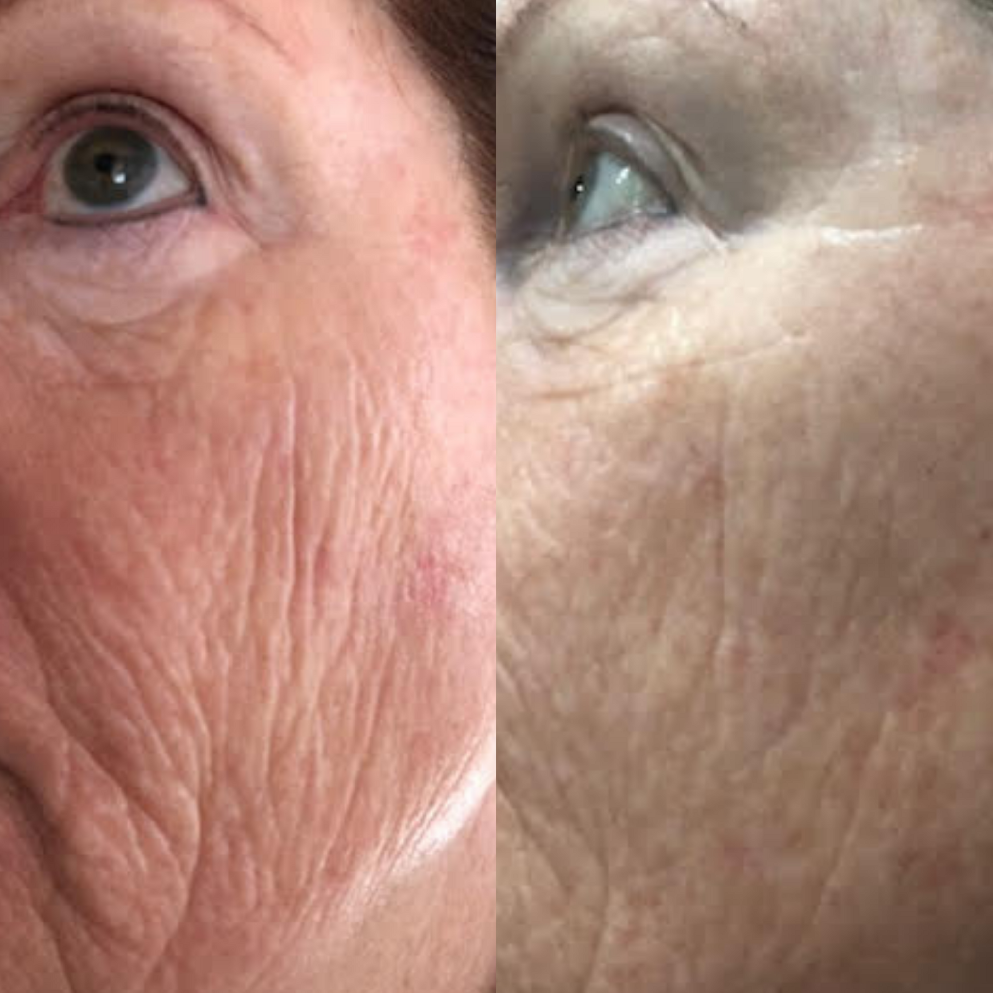 Sea Cucumber Collagen Trio Pack