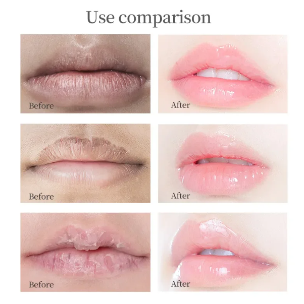 Youth® Deep Lip Mask