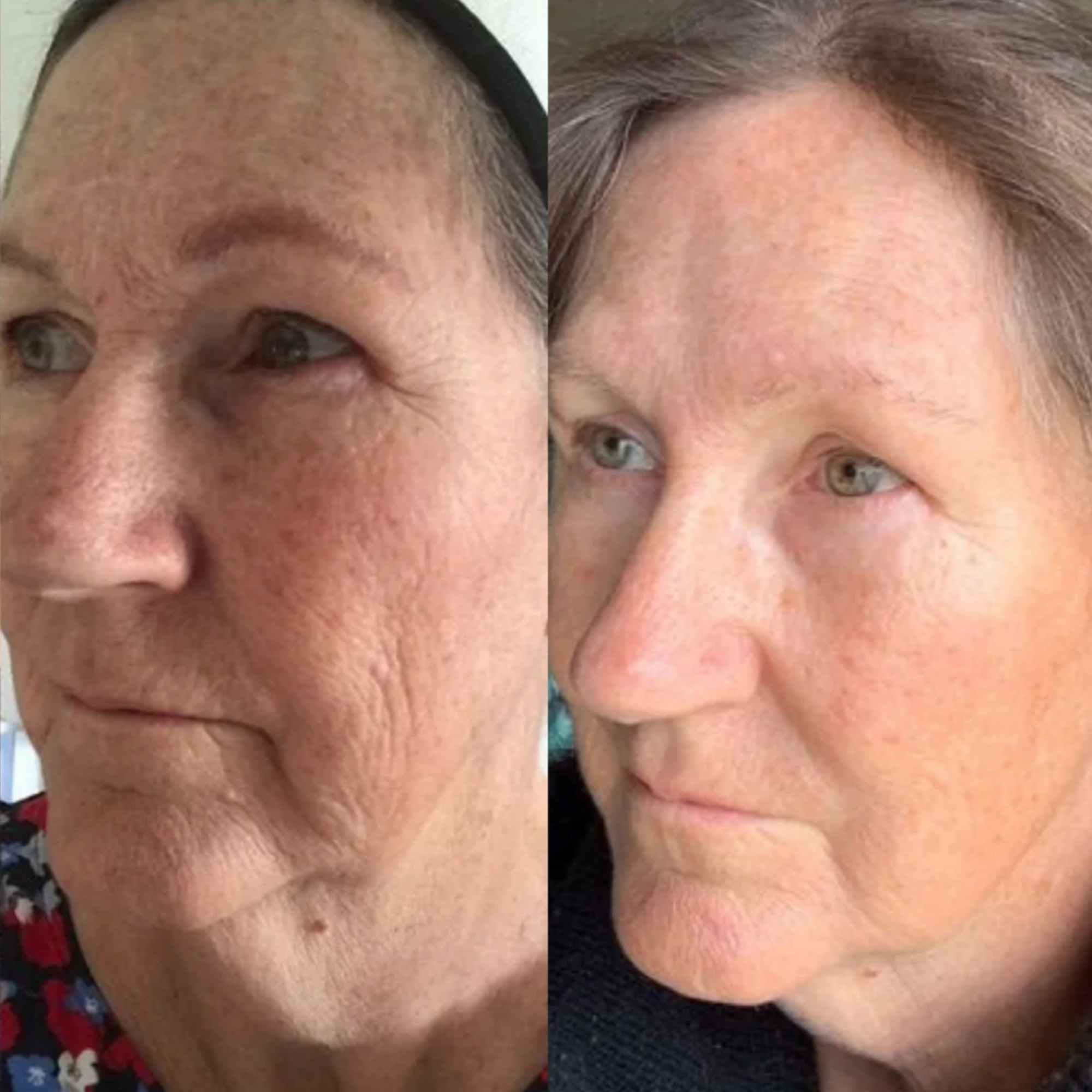 Sea Cucumber Collagen Trio Pack