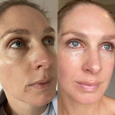 Sea Cucumber Collagen Anti-Ageing Essentials Pack