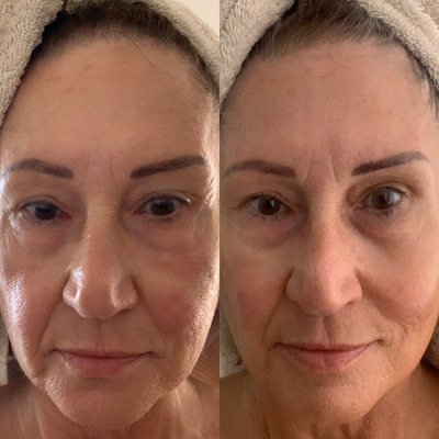 Sea Cucumber Collagen Anti-Ageing Essentials Pack