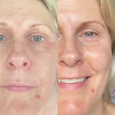Sea Cucumber Collagen Anti-Ageing Essentials Pack