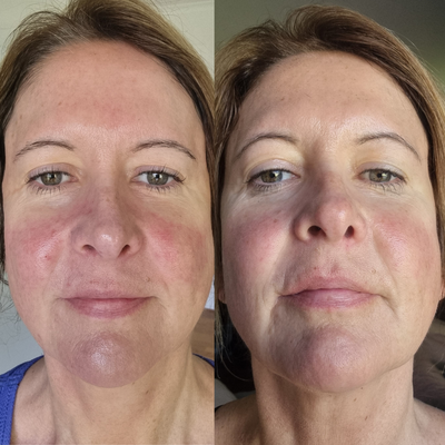 Sea Cucumber Collagen Collection