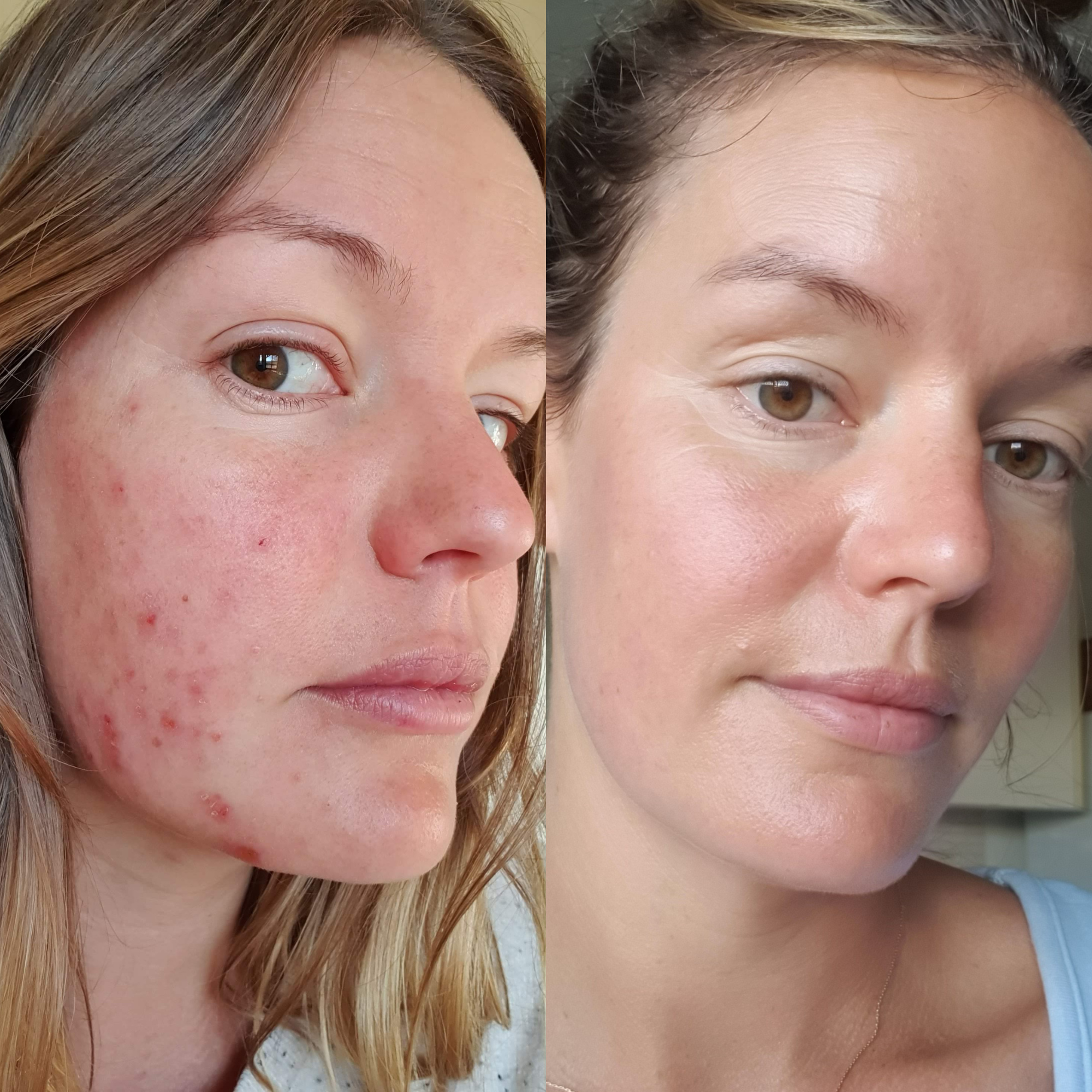 Sea Cucumber Collagen Trio Pack