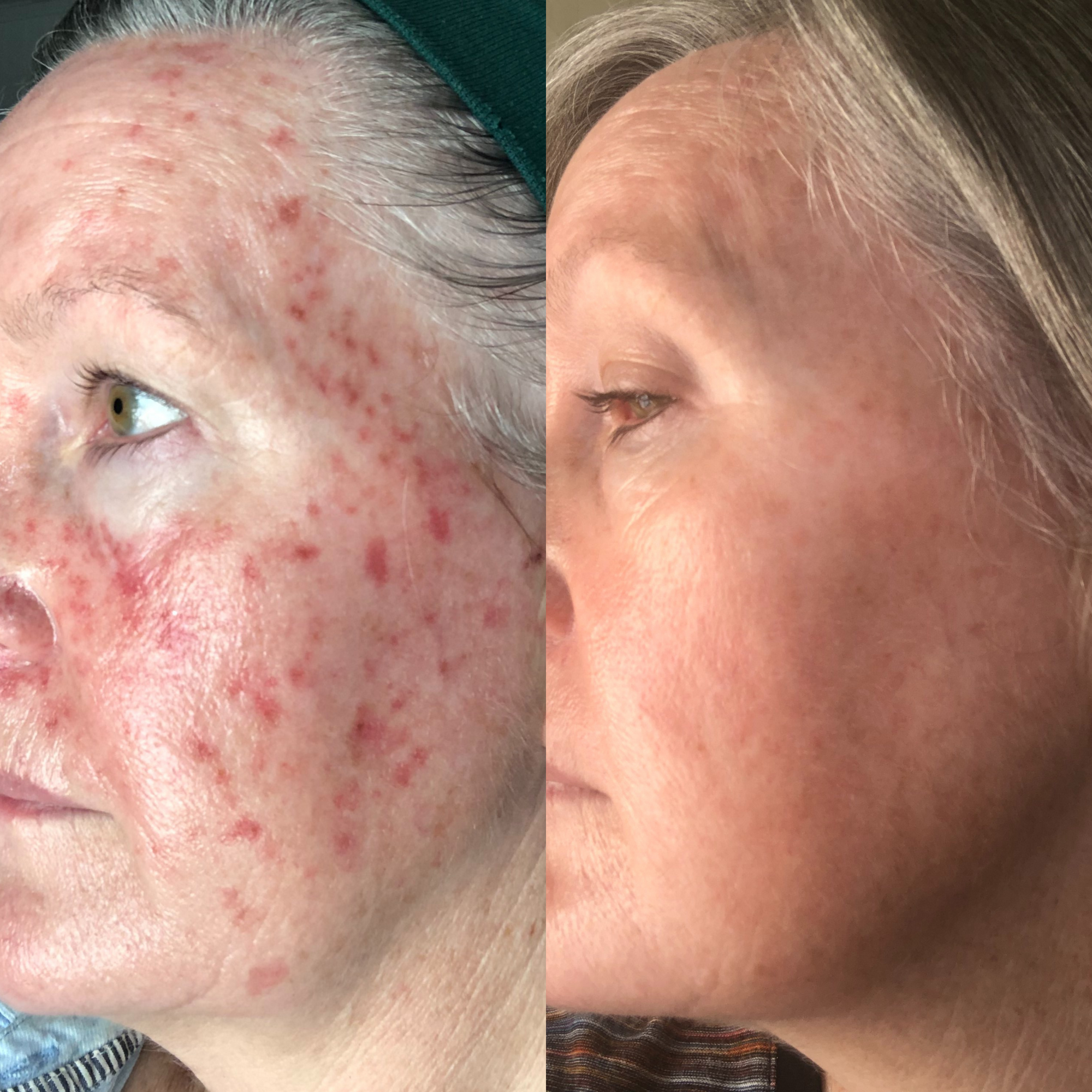 Sea Cucumber Collagen Trio Pack