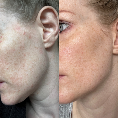 Sea Cucumber Collagen Anti-Ageing Essentials Pack